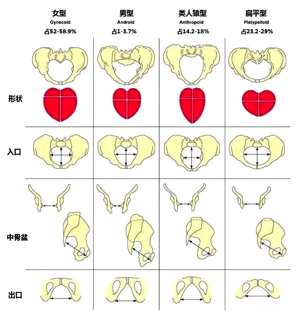 女性的骨盆分为4种类型